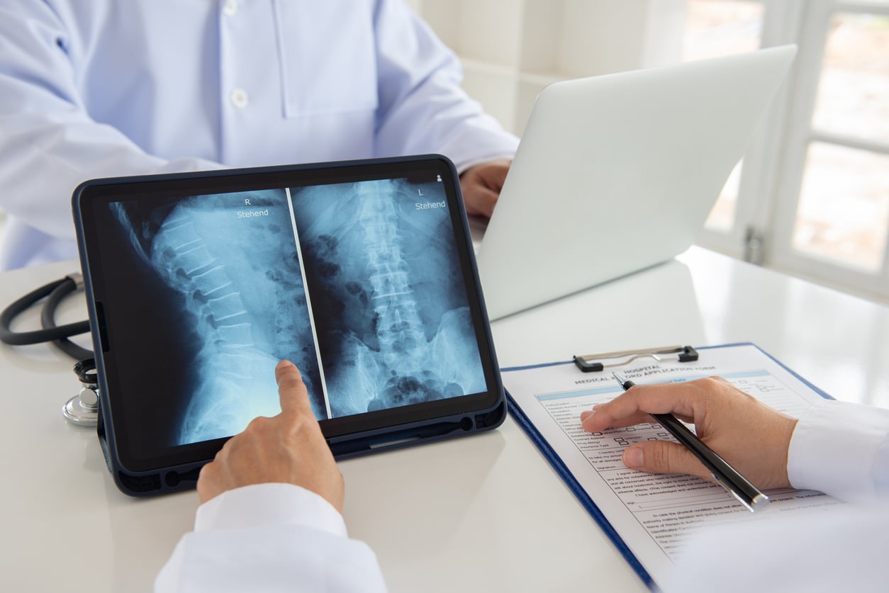 spinal cord